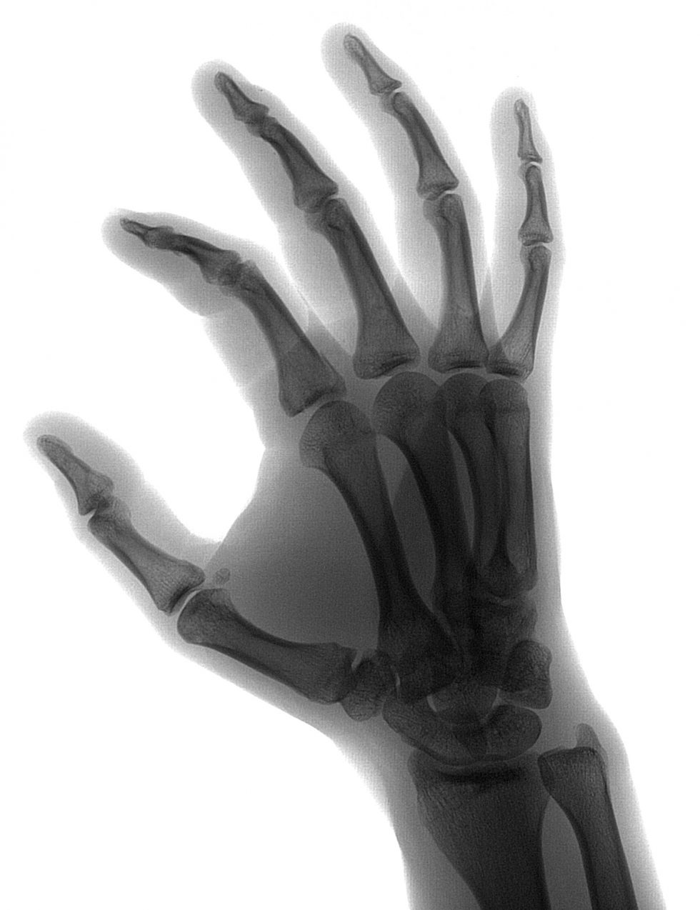 January, 2022 - Xplore Radiology