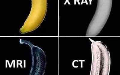 What’s the difference between an X-ray, CT, and MRI?