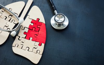 Free Lung Cancer Screening Now Available at Xplore Radiology