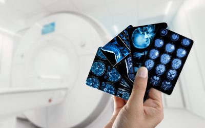 Preventive Imaging: How Early Detection Can Save Lives
